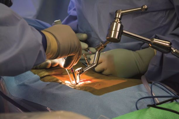 Microscopic Spinal Surgery done by The Best